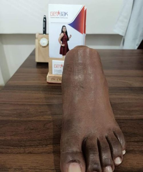 Partial Foot Silicon Prosthesis