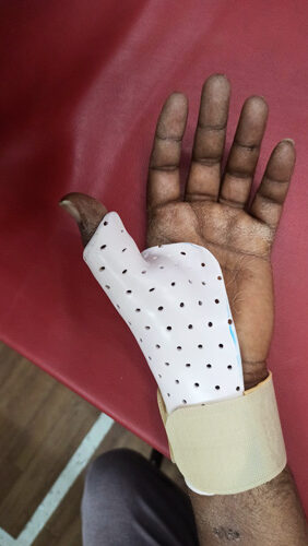 Hand Static Splint